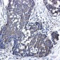 NME3 Rabbit mAb ABZ2184