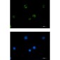 PAK1 Rabbit mAb ABZ2190
