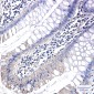 PAK1 Rabbit mAb ABZ2191