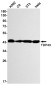 TDP43 Rabbit mAb ABZ2192