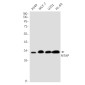 MTAP Rabbit mAb ABZ2194