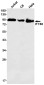 IFT88 Rabbit mAb ABZ2196