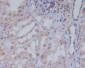 Acetyl Coenzyme A Carboxylase Rabbit mAb ABZ2197