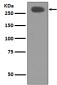 Acetyl Coenzyme A Carboxylase Rabbit mAb ABZ2197