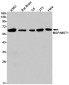 MSP/MST1 Rabbit mAb ABZ2198