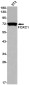 FOXC1 Rabbit mAb ABZ2202