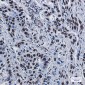 ILF3 Rabbit mAb ABZ2204