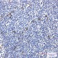 MERTK Rabbit mAb ABZ2207