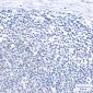 SNF5/SMARCB1 Rabbit mAb ABZ2210