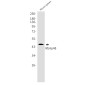 RBBP4 Rabbit mAb ABZ2213