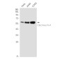 Calcineurin A Rabbit mAb ABZ2216