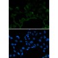 SF2 Rabbit mAb ABZ2218