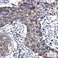 FMRP Rabbit mAb ABZ2228