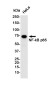 NF-KB p65 Rabbit mAb ABZ2248