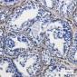 Caveolin-1 Rabbit mAb ABZ2254