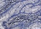 MEK1/2 Rabbit mAb ABZ2257
