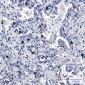FLI1 Rabbit mAb ABZ2267