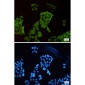 SET Rabbit mAb ABZ2270