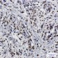 SET Rabbit mAb ABZ2270
