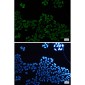 E2F1 Rabbit mAb ABZ2271