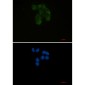 YB1 Rabbit mAb ABZ2307