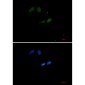 SUMO Conjugating Enzyme UBC9 Rabbit mAb ABZ2310