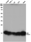 RBX1 Rabbit mAb ABZ2320