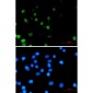 FOXA1 Rabbit mAb ABZ2366