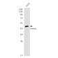 FOXA1 Rabbit mAb ABZ2366