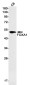 FOXA1 Rabbit mAb ABZ2366