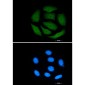VCP Rabbit mAb ABZ2374