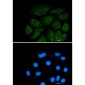 ATP Citrate lyase Rabbit mAb ABZ2387