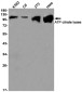 ATP Citrate lyase Rabbit mAb ABZ2387