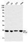 PLGF Rabbit mAb ABZ2434
