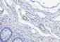 CD146 Rabbit mAb ABZ2488