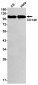 CD146 Rabbit mAb ABZ2488