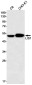 LIS1 Rabbit mAb ABZ2489