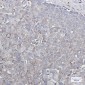 Glutamate receptor 2 Rabbit mAb ABZ2499