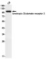 Glutamate receptor 2 Rabbit mAb ABZ2499