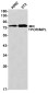 Thrombopoietin Receptor Rabbit mAb ABZ2520