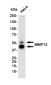 MMP12 Rabbit mAb ABZ2521