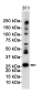 DDIT3 Rabbit mAb ABZ2536