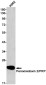 Peroxiredoxin 2 Rabbit mAb ABZ2564