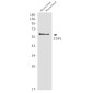STIP1/STI1 Rabbit mAb ABZ2568