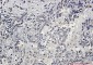AKT1/2/3 Rabbit mAb ABZ2570