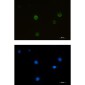 RRM2 Rabbit mAb ABZ2574