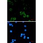 Adenosine A1 Receptor Rabbit mAb ABZ2579