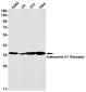 Adenosine A1 Receptor Rabbit mAb ABZ2579