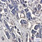 Peroxiredoxin 3/PRDX3 Rabbit mAb ABZ2584