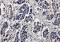 ERK2 Rabbit mAb ABZ2594